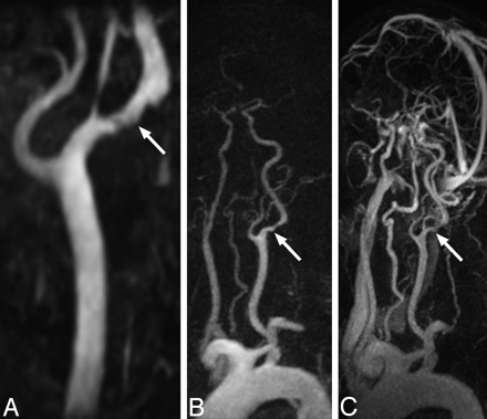 Fig 3.