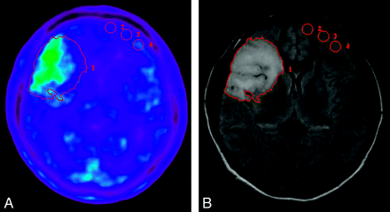 Fig 1.
