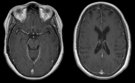 Fig 1.