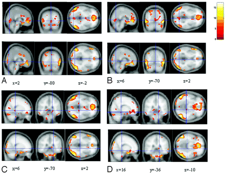 Fig 3.