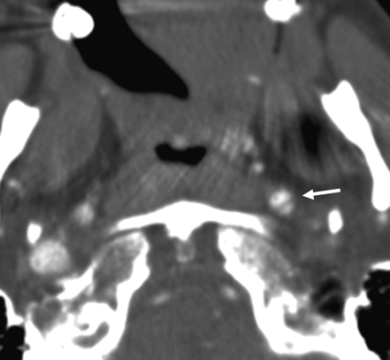 Fig 2.