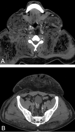   Fig 1. 