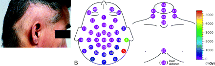 Fig 7.