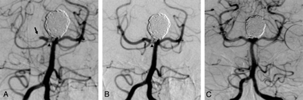 Fig 1.