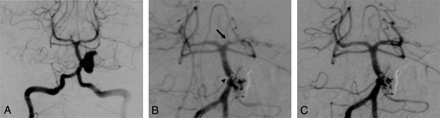 Fig 2.