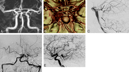 Fig 2.