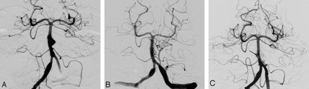 Fig 3.