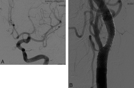 Fig 3.