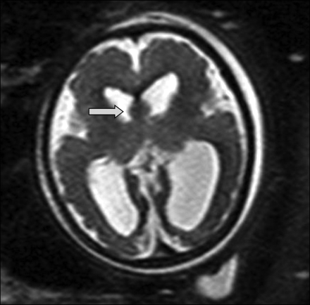 Fig 1.