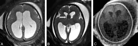 Fig 2.