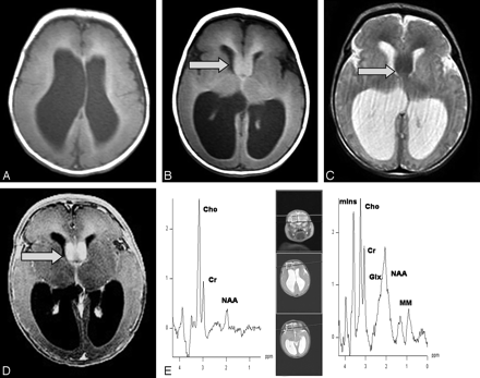 Fig 3.