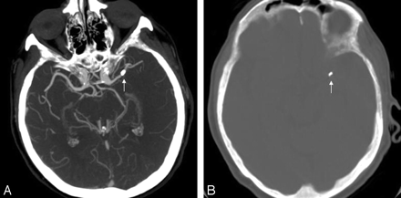 Fig 2.