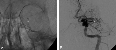 Fig 3.