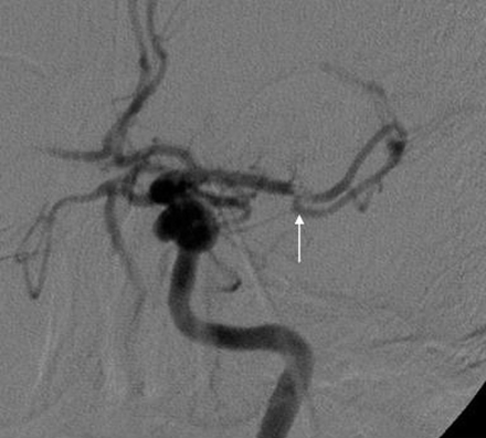 Fig 4.