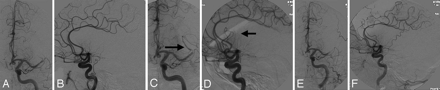 Fig 1.