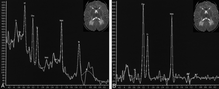 Fig 4.
