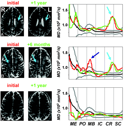 Fig 3.