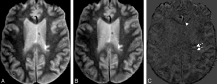 Fig 2.