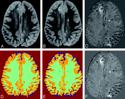 Fig 6.