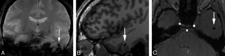 Fig 2.
