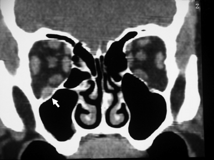 Fig 2.