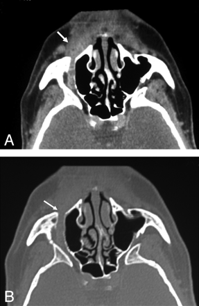 Fig 3.