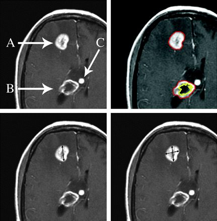 Fig 1.