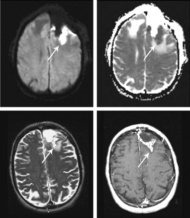 Fig 2.