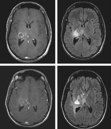 Fig 3.