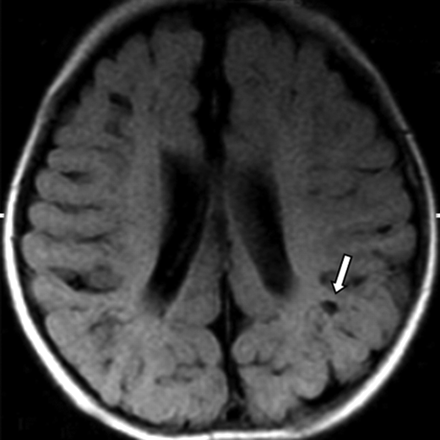 Fig 3.
