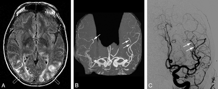 Fig 1.