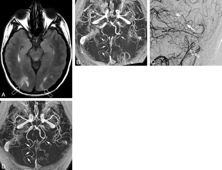 Fig 3.