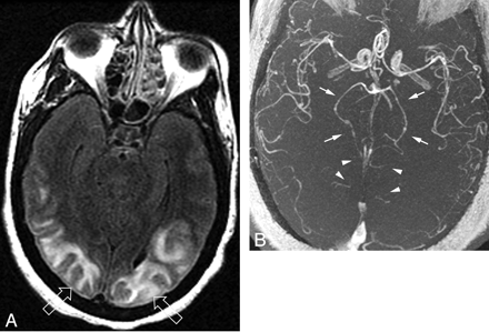Fig 4.