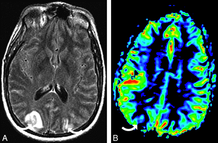 Fig 6.