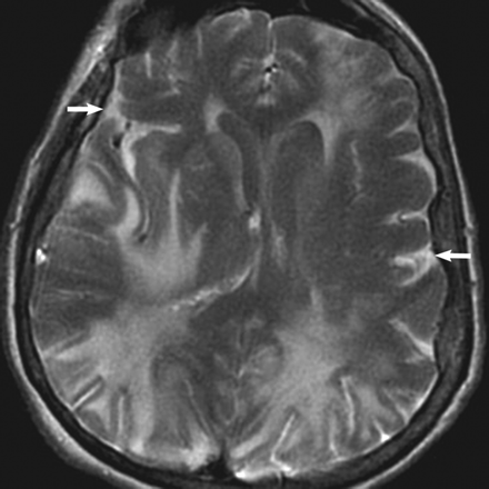 Fig 2.