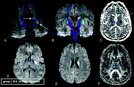 Fig 1.