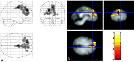 Fig 2.
