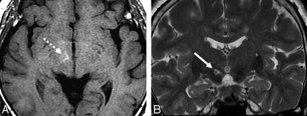   Fig 1. 
