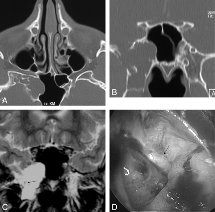 Fig 4.