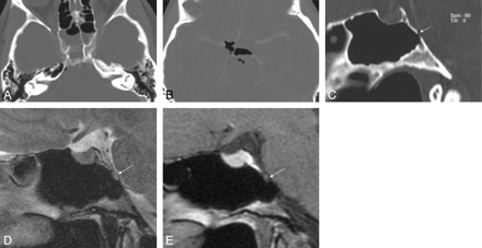 Fig 5.