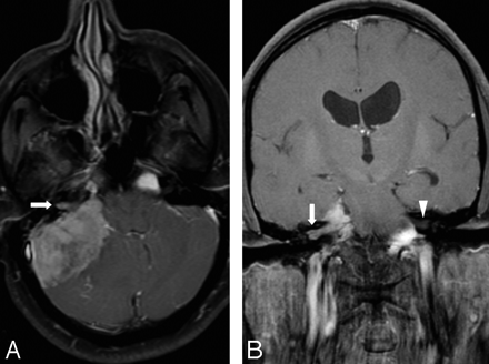 Fig 2.