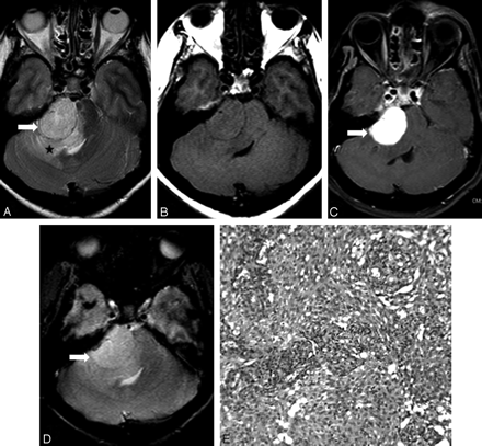 Fig 3.
