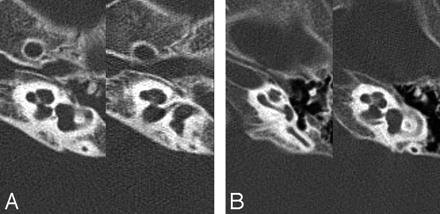 Fig 2.