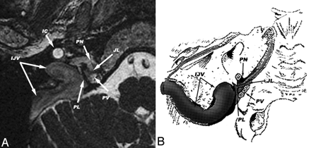 Fig 1.