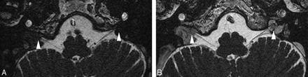Fig 2.