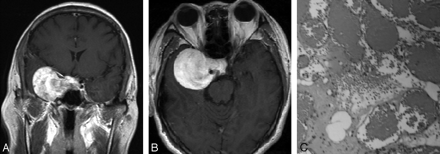 Fig 2.