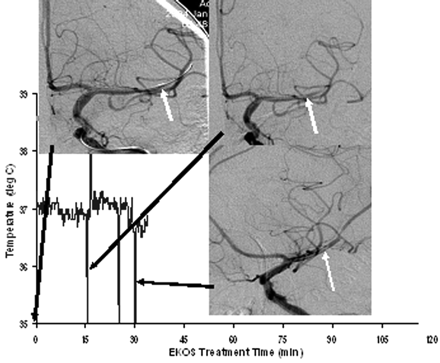 Fig 3.