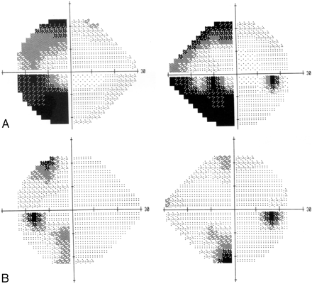 Fig 1.