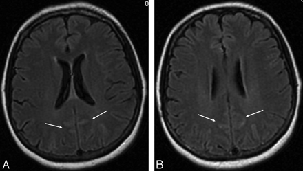 Fig 3.