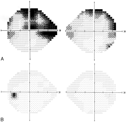 Fig 4.